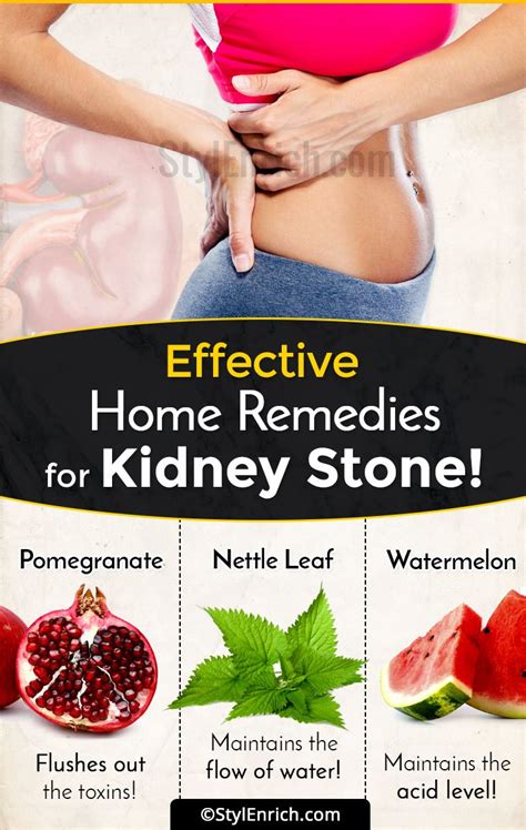 Home Remedies For Kidney Stone That You Must Be Aware Of