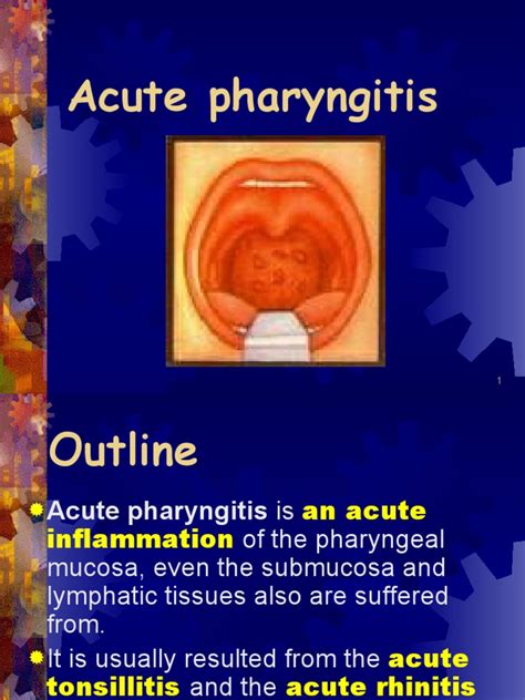 1acute Pharyngitis Pdf Immunology Medicine