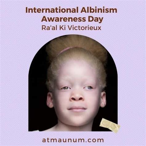 International Albinism Awareness Day Atma Unum