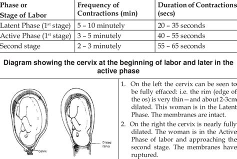 A small number of women will require assistance with their births, either by forceps or the final stage of labour is delivery of the placenta. Uterine Contractions at various stages of Labor | Download ...