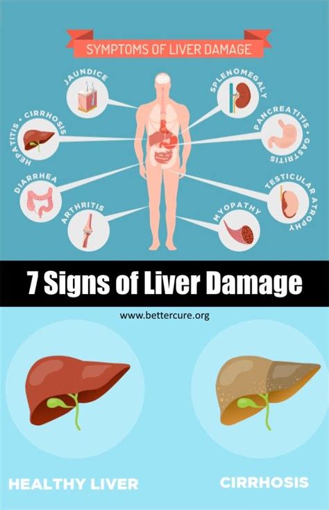 7 Signs Of Liver Damage Liver Failure Symptoms Liver Problems Liver