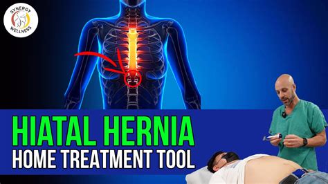 Hiatal Hernia Home Treatment Tool Youtube