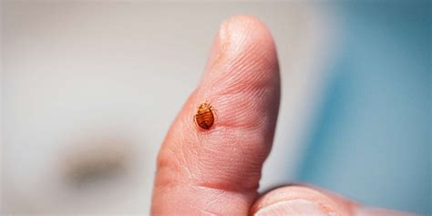 bedbugs in france they can be found wherever people go