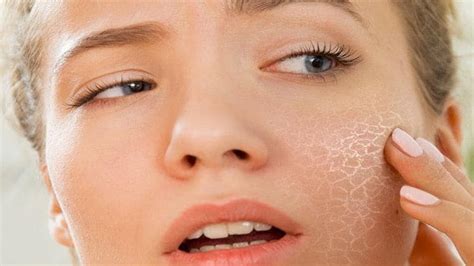 What Is The Difference Between Dry Skin And Dehydrated Skin Hitwebiz