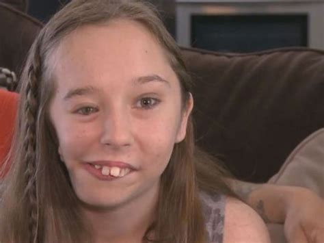 Teen With Facial Deformity Finds Reason To Smile Wtsp Com