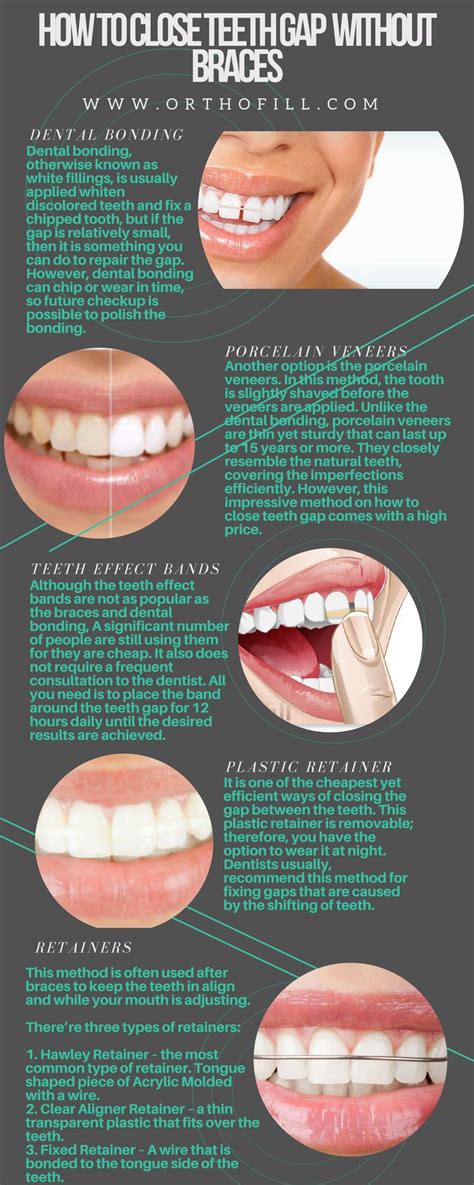 In this post, you will get to know those best ways to close teeth gaps. Pin on Orthofill
