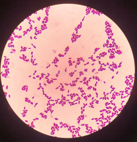 Yeast Cells In Gram Stain With Gentian Violet Viewed Under A