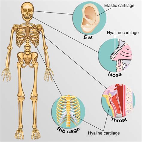 The head, or the spherical body part that contains the brain and rests at the top of the human body, has quite a few individual organs and body parts on it. Relapsing Polychondritis: Causes, Picture, Symptoms and ...