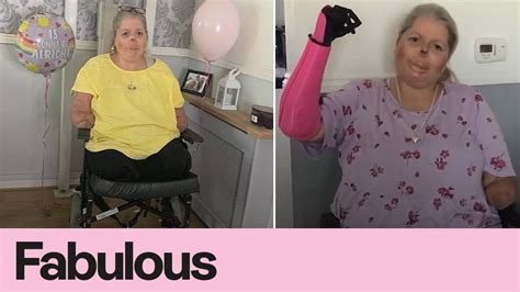 Inspiring Mum Who Lost All Four Limbs To Brutal Sepsis Receives First Bionic Hero Arm Youtube