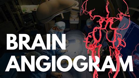 Angiogram Brain Angio Procedure Video Youtube