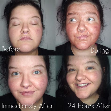 Before And After Ancientsunriseblog