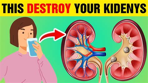 8 Everyday Habits That Destroy Your Kidneys Shocking Truth Revealed