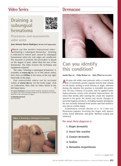 Pdf Draining A Subungual Hematoma Procedures And Assessments Video