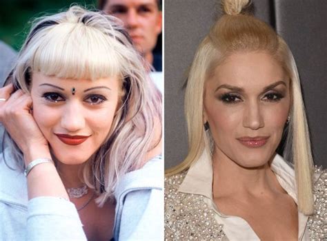 Gwen Stefani Before And After Celebrity Surgery Celebrity Plastic Surgery Nose Job