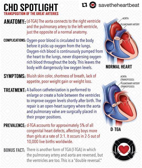 2 Of 3 Repost Savetheheartbeat Learn About Transposition Of The Great