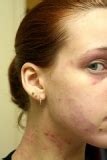 Images of Makeup Allergy