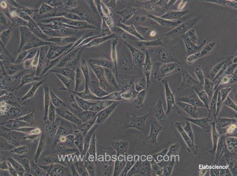 Maybe you would like to learn more about one of these? Purchase MDA-MB-231 Cell Line EP-CL-0150 for research and ...
