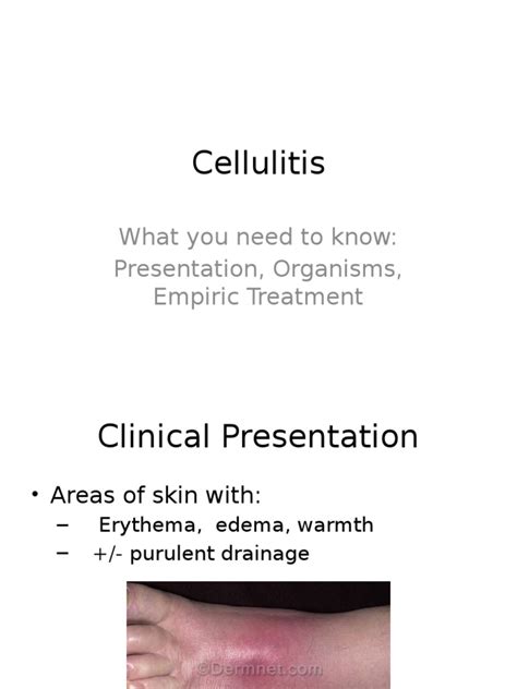 Cellulitis What You Need To Know Presentation Organisms Empiric