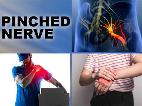 Pinched Nerve Symptoms Causes Diagnosis And Treatment