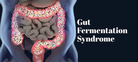 gut fermentation syndrome what you really need to know