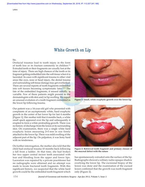 Pdf White Growth On Lip