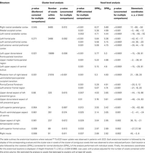 Frontiers Brain Perfusion Impairment In Neurologically Asymptomatic