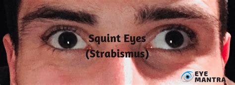 Serious pain may be a sign of an infection or other complications. Eye Muscle Surgery | Facts, Procedure, Recovery and Risks ...