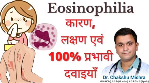 Eosinophilia Homeopathic Treatment Eosinophilia Homeopathic Medicine