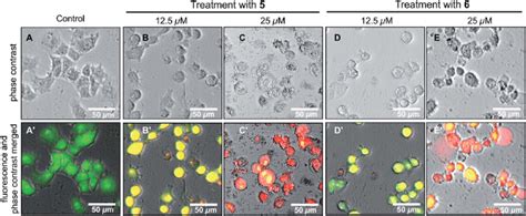 Morphological Changes Of PANC 1 Human Pancreatic Cancer Cells Induced