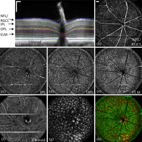 In Vivo Wide Field Multispectral Scanning Laser Ophthalmoscopyoptical