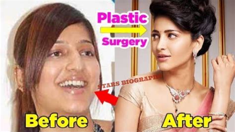 South Indian Actresses Before And After Plastic Surgery You Wont Believestars Biography