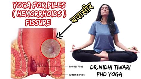 Yoga For Piles Hemorrhoids Fissure बवासीर Dr Nidhitiwari Youtube