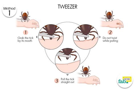 How To Remove A Tick Safely Without Any Pain Fab How