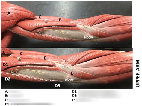 Muscles Of The Upper Arm Lab Model Diagram Quizlet