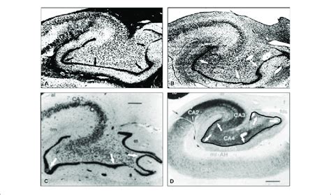Morphology Of The Human Dentate Gyrus Granule Cell Layer In