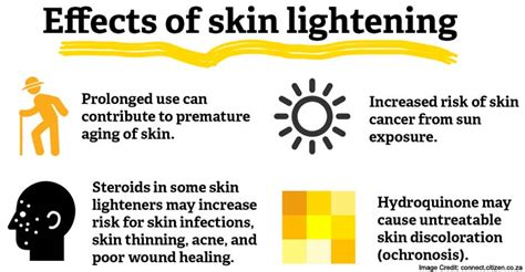 Skin Lightening Know About Its Treatment And Associated Risk