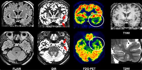 Frontiers Making The Invisible Visible Advanced Neuroimaging