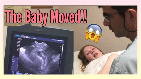 First Ultrasound 8 Weeks Pregnant Early Movement Youtube