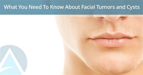 What You Need To Know About Facial Tumors And Cysts Facial Surgery I