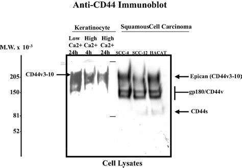 Detection Of Cd44 Isoform Expression In Normal Keratinocytes And Scc