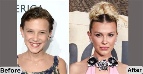 Millie Bobby Brown Plastic Surgery The Curious Case Of Television Star