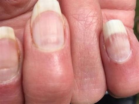 Things Your Nails Can Tell You About Your Health Femanin