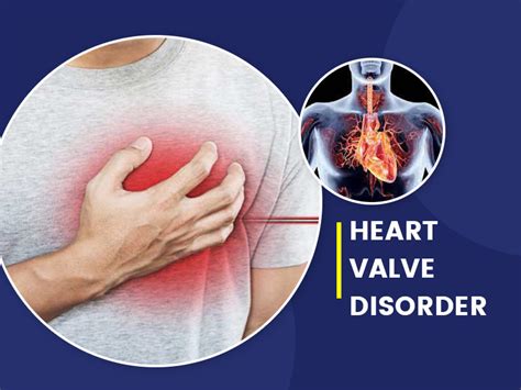Types Symptoms And Causes Of Heart Valve Disease Onlymyhealth