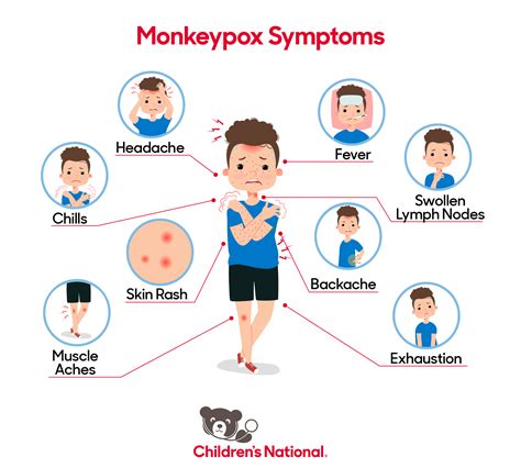 Everything You Need To Know About Monkeypox Childrens National