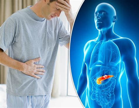 Pancreatic Cancer Symptoms And Causes Three Early Signs Of The Disease