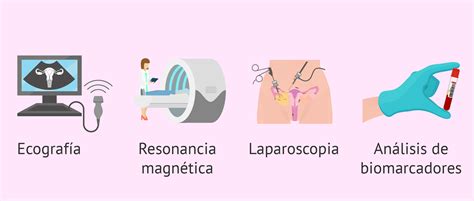 Find out what each endometriosis stage really means doctors explain how to tell if you have a head cold or something more serious that requires medical attention, such as the flu, strep throat, meningitis, or. Diagnóstico de la endometriosis