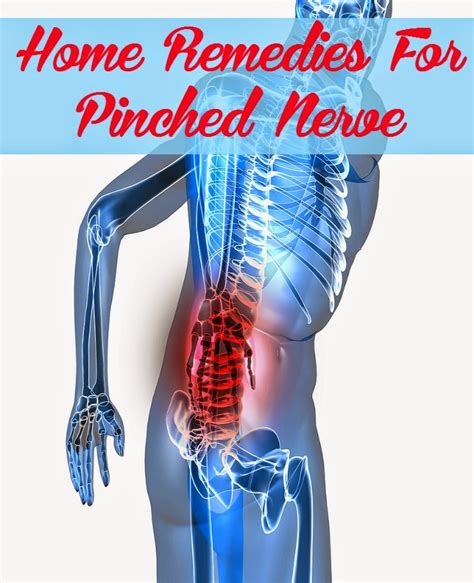 Home Remedies For Pinched Nerve Tips Park