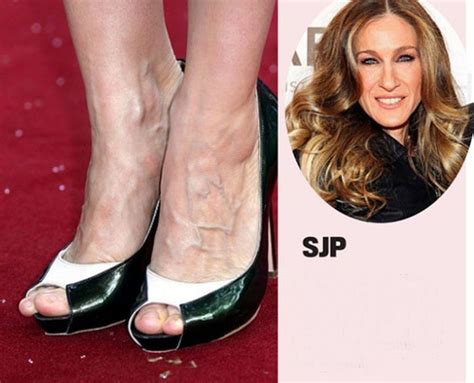 Celebrities With Ugly Feet 15 Pics