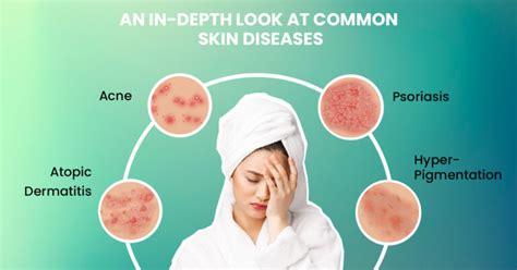 A Guide To Common Skin Issues And Treatment Options Thomson Specialist