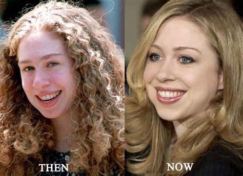 Inspired by the #1 new york times bestseller she persisted by chelsea clinton and alexandra boiger comes a chapter book series about women who. Chelsea Clinton Plastic Surgery Before and After Nose Job ...